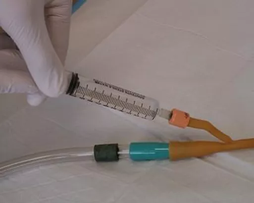 Catheter Removal