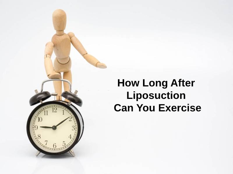 How Long After Liposuction Can You