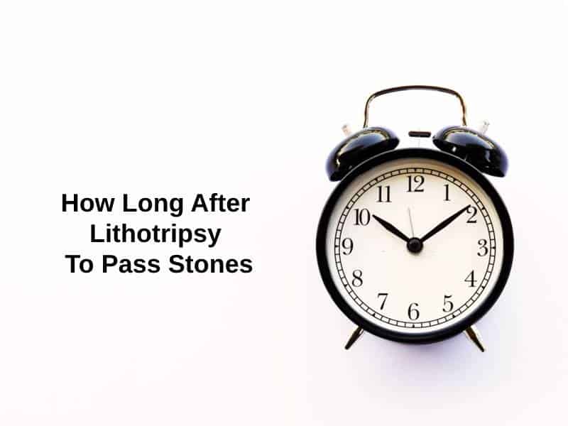 How Long After Lithotripsy To Pass Stones