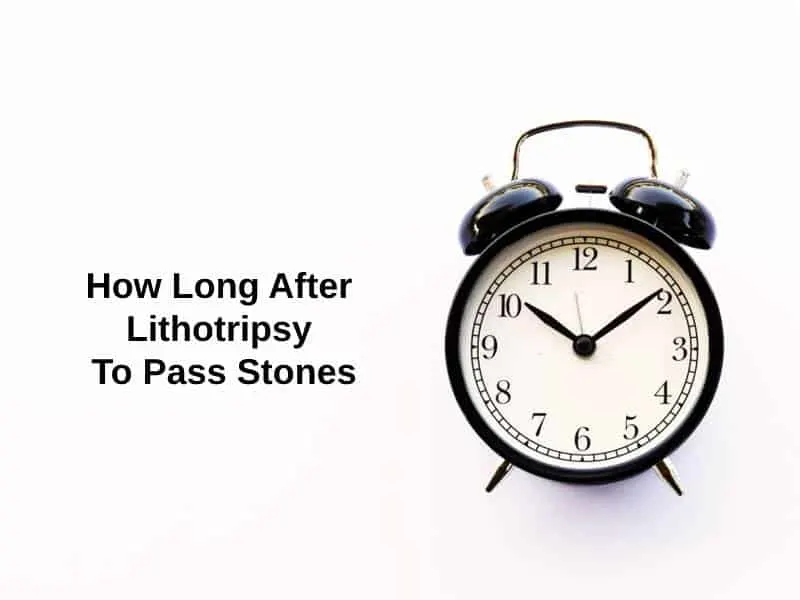 How Long After Lithotripsy To Pass Stones