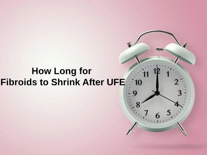 How Long for Fibroids to Shrink After UFE