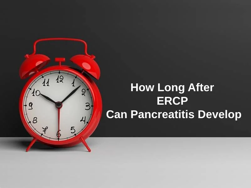 How Long After ERCP Can Pancreatitis Develop