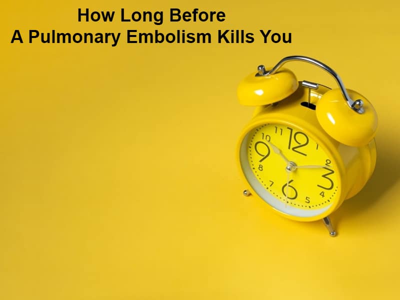 How Long Before A Pulmonary Embolism Kills You
