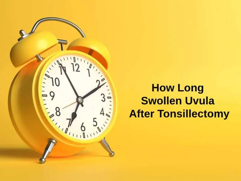 How Long Swollen Uvula After Tonsillectomy
