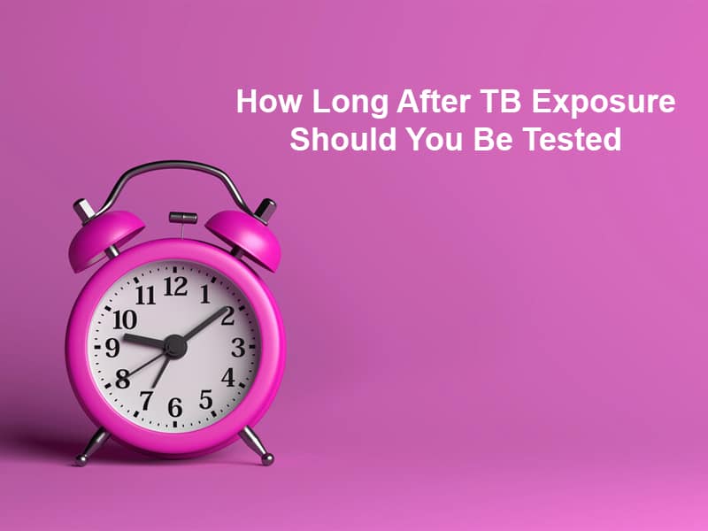 How Long After TB Exposure Should You Be Tested