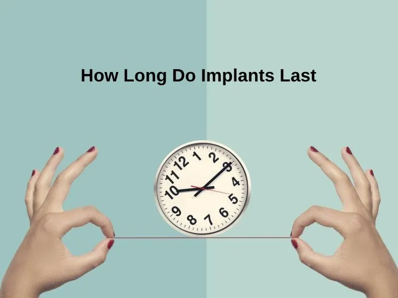 How Long Do Implants Last