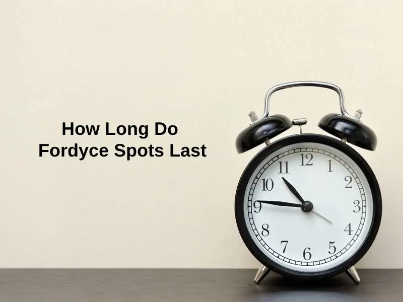 How Long Do Fordyce Spots Last