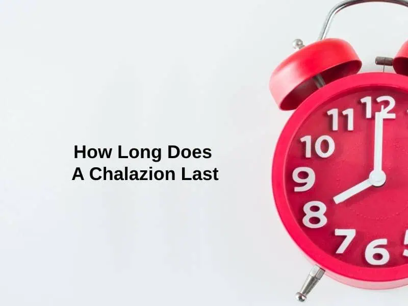 How Long Does A Chalazion Last