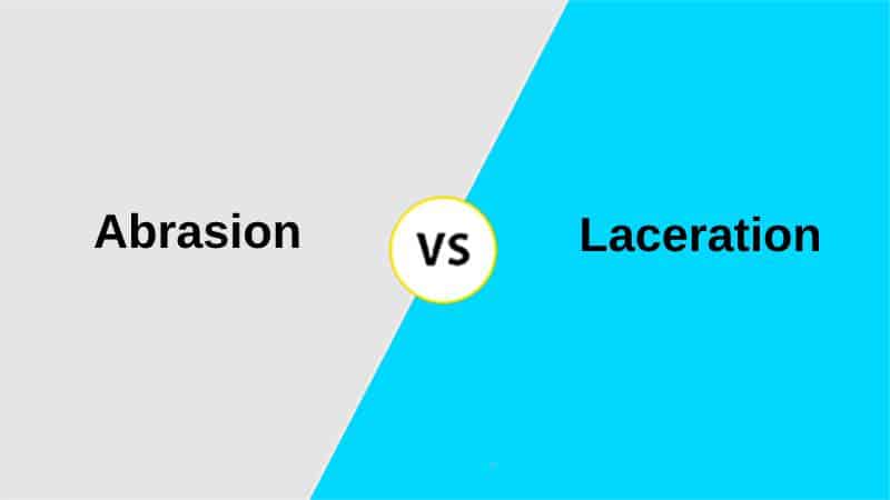 Difference Between Abrasion and Laceration (With Table)