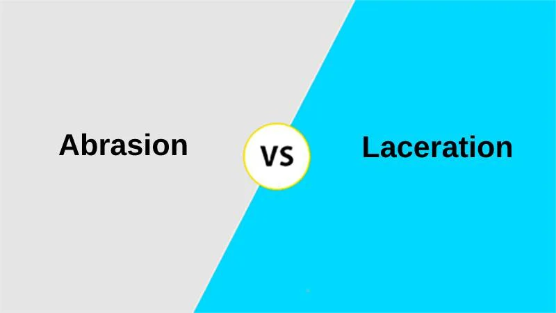 Difference Between Abrasion and Laceration