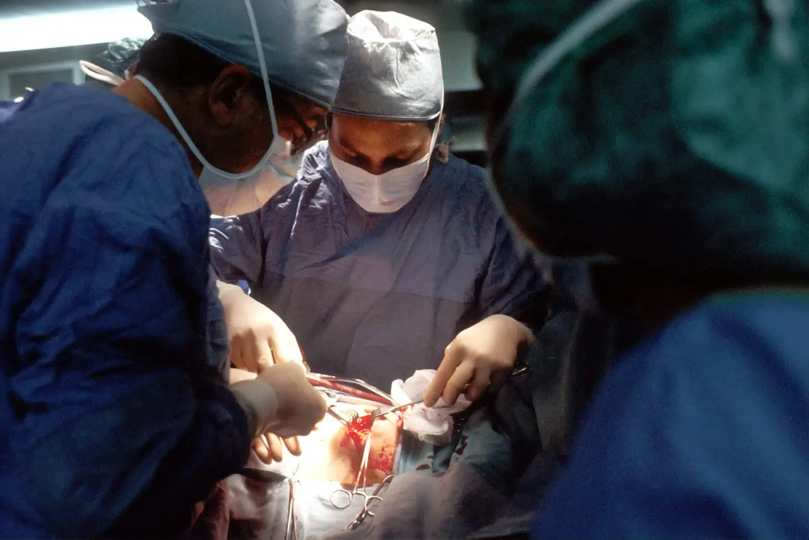 Aortic Aneurysm Surgery