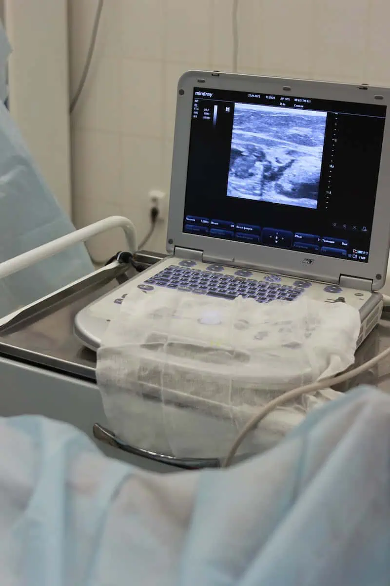 Miscarriage Ultrasound